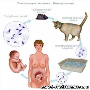 Симптомы токсоплазмоза – токсоплазмоз при беременности – источник инфекции